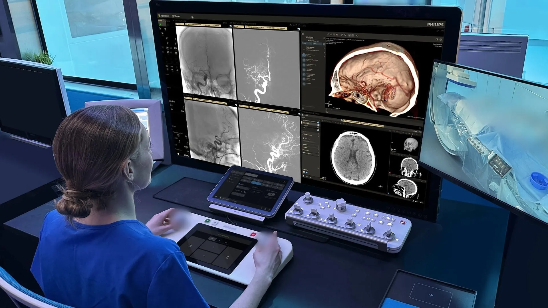 Ictus: IA e nuove tecnologie da Philips per il suo trattamento